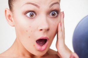 Khẩu trang vải khắc phục vấn đề da
